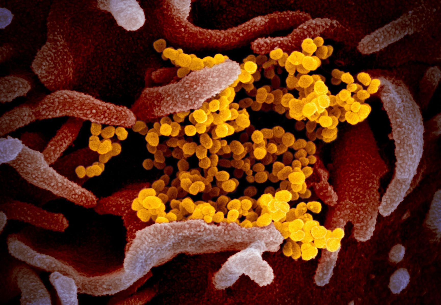 Coronavirus